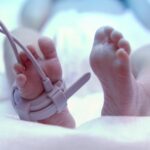 Umbilical cord blood biomarkers could identify babies at risk of brain damage