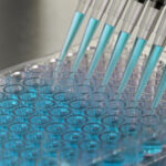 Horizon 2020 stem cell study moves to clinical trial phase
